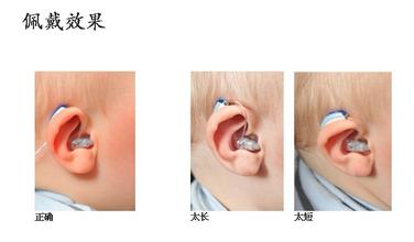 儿童助听器配戴效果图
